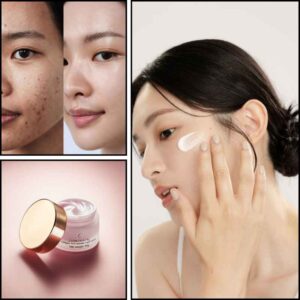 Gia Công Kem Face Trị Nám